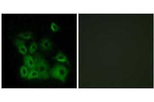 Immunofluorescence analysis of A549 cells, using BAX (Phospho-Thr167) antibody. (BAX Antikörper  (pThr167))