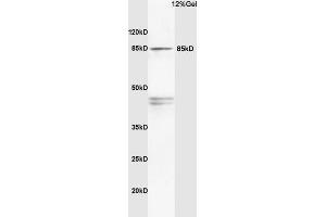 Rat brain lysates probed with Anti PI3K/PI3 kinase p85 alpha subunit Polyclonal Antibody, Unconjugated (ABIN725405) at 1:200 in 4 °C. (PIK3R1 Antikörper  (AA 501-600))