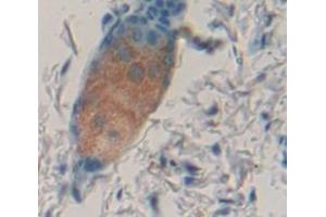 IHC-P analysis of Mouse Tissue, with DAB staining. (IL1F9 Antikörper  (AA 5-149))