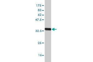 Western Blot detection against Immunogen (33. (ZIC4 Antikörper  (AA 249-319))