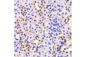 Immunohistochemistry of paraffin-embedded mouse kidney using HNRNPA1 Antibody (ABIN5975570) at dilution of 1/100 (40x lens). (HNRNPA1 Antikörper)