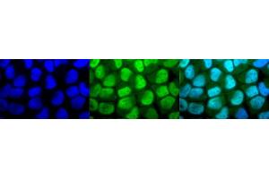 Immunocytochemistry/Immunofluorescence analysis using Rabbit Anti-Methylated Lysine Polyclonal Antibody (ABIN5650776). (Lysine (lys) (methylated) Antikörper)