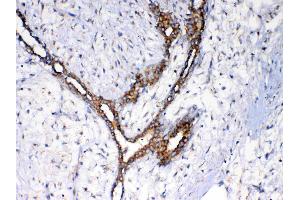 Immunohistochemistry (IHC) image for anti-N-Ethylmaleimide-Sensitive Factor (NSF) (AA 620-744) antibody (ABIN5693126)
