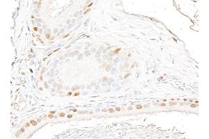 anti-Androgen Receptor (AR) (AA 1-50) antibody