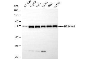 anti-Ribosomal Protein S6 Kinase, 90kDa, Polypeptide 3 (RPS6KA3) antibody
