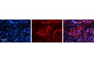 Rabbit Anti-HSPA4 Antibody   Formalin Fixed Paraffin Embedded Tissue: Human Testis Tissue Observed Staining: Cytoplasm in spermatogonia and Leydig cells Primary Antibody Concentration: 1:100 Other Working Concentrations: 1:600 Secondary Antibody: Donkey anti-Rabbit-Cy3 Secondary Antibody Concentration: 1:200 Magnification: 20X Exposure Time: 0. (HSPA4 Antikörper  (N-Term))