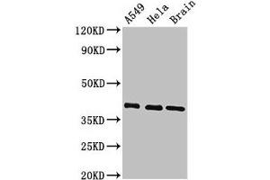 Western Blot Positive WB detected in: A549 whole cell lysate, Hela whole cell lysate, Mouse brain tissue All lanes: HLA-C antibody at 3. (HLA-C Antikörper  (AA 62-306))