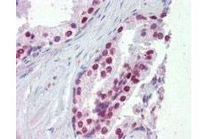 FOXA1 polyclonal antibody  (5 ug/mL) staining of paraffin embedded human prostate. (FOXA1 Antikörper  (C-Term))