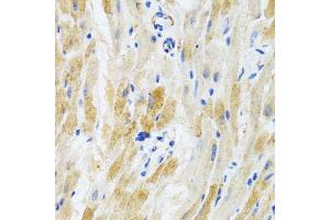 Immunohistochemistry of paraffin-embedded mouse heart using PHPT1 antibody. (PHPT1 Antikörper  (AA 1-125))