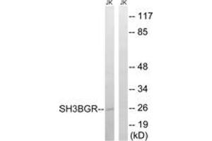 Western blot analysis of extracts from Jurkat cells, using SH3BGR Antibody. (SH3BGR Antikörper  (AA 81-130))