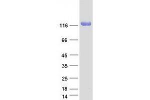 Validation with Western Blot (KIAA1324-Like Protein (KIAA1324L) (Transcript Variant 1) (Myc-DYKDDDDK Tag))