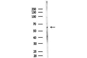 anti-KIAA0391 (KIAA0391) (Internal Region) antibody