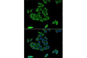 Immunofluorescence analysis of U2OS cells using TGM3 antibody (ABIN6132263, ABIN6149094, ABIN6149095 and ABIN6221560). (TGM3 Antikörper  (AA 1-180))