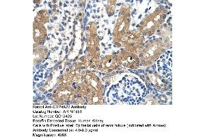 Rabbit Anti-CYP4A22 Antibody  Paraffin Embedded Tissue: Human Kidney Cellular Data: Epithelial cells of renal tubule Antibody Concentration: 4.