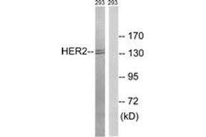 Western blot analysis of extracts from 293 cells, treated with Ca2+ 40nM 30', using HER2 (Ab-1112) Antibody. (ErbB2/Her2 Antikörper  (AA 1081-1130))