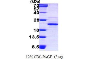 DCTP Pyrophosphatase 1 (DCTPP1) (AA 1-170) protein (His tag)