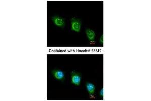 ICC/IF Image Immunofluorescence analysis of methanol-fixed HeLa, using USP47, antibody at 1:200 dilution. (USP47 Antikörper)