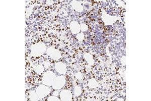 Immunohistochemical staining (Formalin-fixed paraffin-embedded sections) of human bone marrow with PADI4 polyclonal antibody  shows strong cytoplasmic and nuclear positivity in subset of hematopoietic cells. (PAD4 Antikörper)