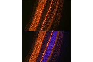 Immunofluorescence analysis of rat eye using V Rabbit mAb (ABIN7271313) at dilution of 1:100 (40x lens). (VAMP2 Antikörper)