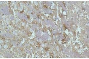 Immunohistochemistry of paraffin-embedded Rat brain tissue with GAP43 Monoclonal Antibody