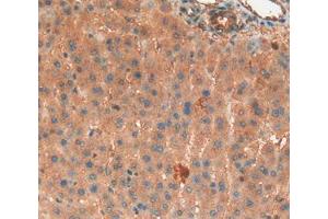 IHC-P analysis of Liver Tissue, with DAB staining. (Haptoglobin Antikörper  (AA 104-346))