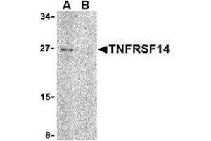 Western blot analysis of TNFRSF14 in Raji cell lysate with this product at 2 μg/ml in (A) the absence and (B) the presence of blocking peptide. (HVEM Antikörper  (C-Term))