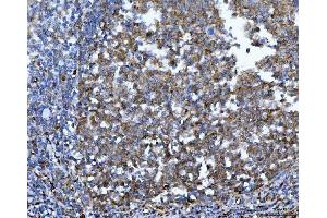 IHC analysis of YWHAE using anti-YWHAE antibody (ABIN7599165).