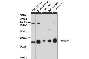 Western blot analysis of extracts of various cell lines, using NDUFS4 Rabbit mAb (ABIN7268821) at 1:1000 dilution.