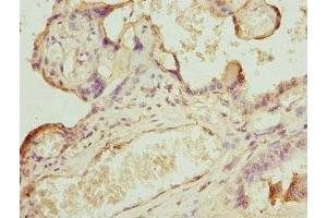 Immunohistochemistry of paraffin-embedded human placenta tissue using ABIN7146436 at dilution of 1:100 (CAMK1D Antikörper  (AA 1-180))