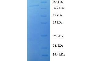 SDS-PAGE (SDS) image for Muscle, Skeletal, Receptor Tyrosine Kinase (MUSK) (AA 24-495), (Extracellular) protein (GST tag) (ABIN5709979)