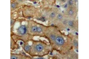 Immunohistochemistry (IHC) image for anti-Leukocyte Immunoglobulin-Like Receptor, Subfamily A (Without TM Domain), Member 3 (LILRA3) (AA 219-438) antibody (ABIN7433585)