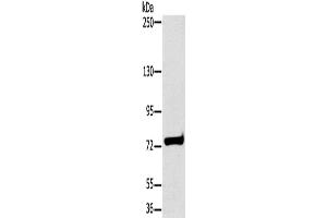 Western Blotting (WB) image for anti-Hydroxysteroid (17-Beta) Dehydrogenase 4 (HSD17B4) antibody (ABIN2430255) (HSD17B4 Antikörper)