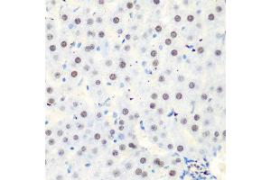 Immunohistochemistry of paraffin-embedded rat liver using CASP9 antibody at dilution of 1:100 (40x lens). (Caspase 9 Antikörper)