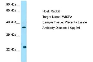 Host: Rabbit  Target Name: WISP2  Antibody Dilution: 1. (WISP2 Antikörper  (C-Term))