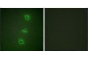 Immunofluorescence analysis of HuvEc cells, using B-RAF Antibody. (SNRPE Antikörper  (AA 171-220))