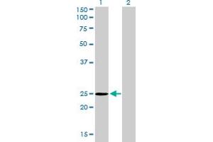 Western Blot analysis of THAP1 expression in transfected 293T cell line by THAP1 monoclonal antibody (M01), clone 2C1-2F2. (THAP1 Antikörper  (AA 1-213))
