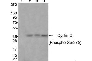 Western blot analysis of extracts from 3T3 cells (Lane 2), A549 cells (Lane 3) and Hela cells (Lane 4), using Cyclin C (Phospho-Ser275) Antibody. (Cyclin C Antikörper  (pSer275))