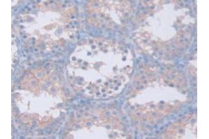 IHC-P analysis of Mouse Testis Tissue, with DAB staining. (GAMT Antikörper  (AA 2-236))
