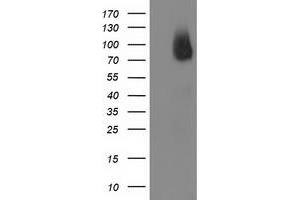 Western Blotting (WB) image for anti-Breast Cancer Anti-Estrogen Resistance 1 (BCAR1) antibody (ABIN1496834) (BCAR1 Antikörper)