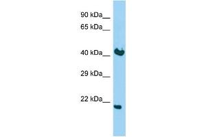 Host: Rabbit Target Name: KDELR2 Sample Type: Fetal Brain lysates Antibody Dilution: 1. (KDELR2 Antikörper  (C-Term))