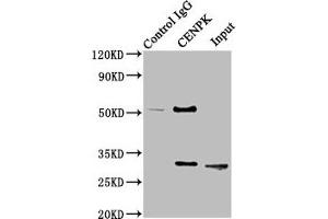 Immunoprecipitating CENPK in Hela whole cell lysate Lane 1: Rabbit control IgG instead of ABIN7147366 in Hela whole cell lysate. (CENPK Antikörper  (AA 1-269))