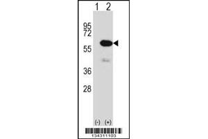 Western blot analysis of METAP2 using rabbit polyclonal METAP2 Antibody using 293 cell lysates (2 ug/lane) either nontransfected (Lane 1) or transiently transfected (Lane 2) with the METAP2 gene.
