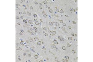 Immunohistochemistry of paraffin-embedded mouse brain using MYO10 antibody. (Myosin X Antikörper)