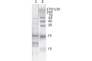 Western Blot testing of HIV-1 recombinant Tat protein. (HIV-1 Tat Antikörper  (AA 6-12))