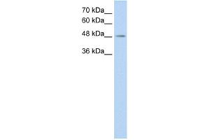WB Suggested Anti-C9orf127 Antibody Titration:  0. (TMEM8B Antikörper  (C-Term))