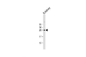 Western Blot at 1:2000 dilution + Rat kidney lysate Lysates/proteins at 20 ug per lane. (EPO Antikörper  (N-Term))