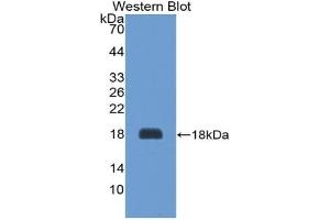 Detection of Recombinant AGRP, Rat using Polyclonal Antibody to Agouti Related Protein (AGRP) (AGRP Antikörper  (AA 34-127))