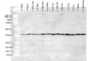 Western blot analysis of Human cancer cell lines showing detection of p38 protein using Rabbit Anti-p38 Polyclonal Antibody . (MAPK14 Antikörper  (PerCP))