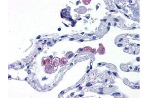 Human Lung: Formalin-Fixed, Paraffin-Embedded (FFPE) (TLR7 Antikörper  (AA 900-950))