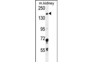 IGSF1 Antibody (C-term) (ABIN654689 and ABIN2844381) western blot analysis in mouse kidney tissue lysates (35 μg/lane).